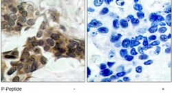 IkB-alpha, p Ser32, p Ser36 Antibody, Novus Biologicals 0.025 mL; Unconjugated:Antibodies,